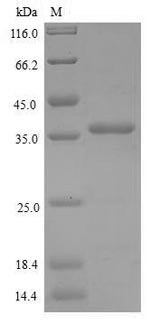 (Tris-Glycine gel) Discontinuous SDS-PAGE (reduced) with 5% enrichment gel and 15% separation gel.