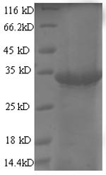 (Tris-Glycine gel) Discontinuous SDS-PAGE (reduced) with 5% enrichment gel and 15% separation gel.