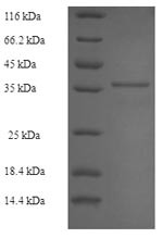 (Tris-Glycine gel) Discontinuous SDS-PAGE (reduced) with 5% enrichment gel and 15% separation gel.