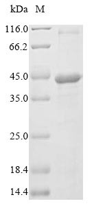 (Tris-Glycine gel) Discontinuous SDS-PAGE (reduced) with 5% enrichment gel and 15% separation gel.