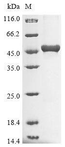 (Tris-Glycine gel) Discontinuous SDS-PAGE (reduced) with 5% enrichment gel and 15% separation gel.