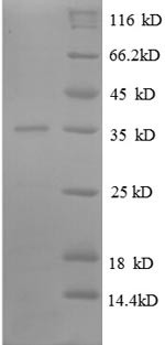 (Tris-Glycine gel) Discontinuous SDS-PAGE (reduced) with 5% enrichment gel and 15% separation gel.