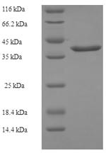 (Tris-Glycine gel) Discontinuous SDS-PAGE (reduced) with 5% enrichment gel and 15% separation gel.