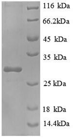 (Tris-Glycine gel) Discontinuous SDS-PAGE (reduced) with 5% enrichment gel and 15% separation gel.