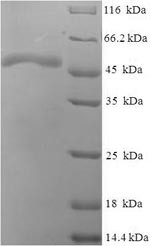 (Tris-Glycine gel) Discontinuous SDS-PAGE (reduced) with 5% enrichment gel and 15% separation gel.