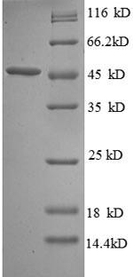 (Tris-Glycine gel) Discontinuous SDS-PAGE (reduced) with 5% enrichment gel and 15% separation gel.