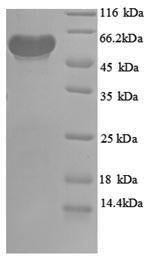 Recombinant Escherichia coli Pyruvate dehydrogenase [ubiquinone] (poxB), partial (CSB-EP356996ENV1)