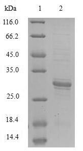 (Tris-Glycine gel) Discontinuous SDS-PAGE (reduced) with 5% enrichment gel and 15% separation gel.