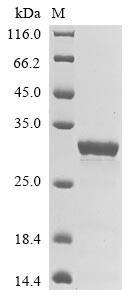 (Tris-Glycine gel) Discontinuous SDS-PAGE (reduced) with 5% enrichment gel and 15% separation gel.