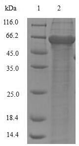 (Tris-Glycine gel) Discontinuous SDS-PAGE (reduced) with 5% enrichment gel and 15% separation gel.
