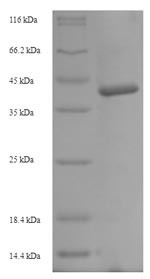 (Tris-Glycine gel) Discontinuous SDS-PAGE (reduced) with 5% enrichment gel and 15% separation gel.