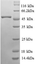 (Tris-Glycine gel) Discontinuous SDS-PAGE (reduced) with 5% enrichment gel and 15% separation gel.