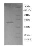 (Tris-Glycine gel) Discontinuous SDS-PAGE (reduced) with 5% enrichment gel and 15% separation gel.