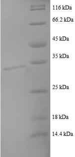 (Tris-Glycine gel) Discontinuous SDS-PAGE (reduced) with 5% enrichment gel and 15% separation gel.
