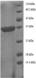 (Tris-Glycine gel) Discontinuous SDS-PAGE (reduced) with 5% enrichment gel and 15% separation gel.