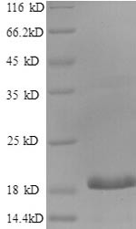 Recombinant Human CCAAT/enhancer-binding protein gamma (CEBPG), partial (CSB-EP005184HU1)