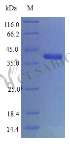 Recombinant Human CCN family member 1(CCN1)(Active) (CSB-AP002661HU)