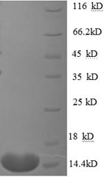 (Tris-Glycine gel) Discontinuous SDS-PAGE (reduced) with 5% enrichment gel and 15% separation gel.