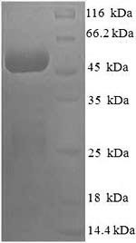 (Tris-Glycine gel) Discontinuous SDS-PAGE (reduced) with 5% enrichment gel and 15% separation gel.