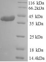 (Tris-Glycine gel) Discontinuous SDS-PAGE (reduced) with 5% enrichment gel and 15% separation gel.