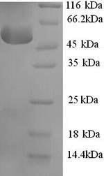 (Tris-Glycine gel) Discontinuous SDS-PAGE (reduced) with 5% enrichment gel and 15% separation gel.