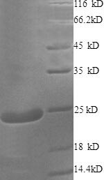 Recombinant Human Cysteine and glycine-rich protein 2 (CSRP2) (CSB-EP006084HU(A4))