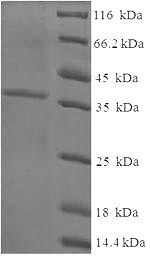 (Tris-Glycine gel) Discontinuous SDS-PAGE (reduced) with 5% enrichment gel and 15% separation gel.