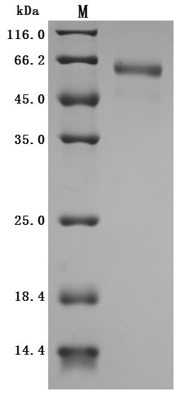(Tris-Glycine gel) Discontinuous SDS-PAGE (reduced) with 5% enrichment gel and 15% separation gel.Predicted band size: 38.2 kDaObserved band size:(a) 68 kDa before EndoH Digestion(b) 38 kDa after EndoH Digestion