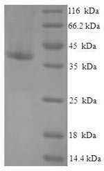 (Tris-Glycine gel) Discontinuous SDS-PAGE (reduced) with 5% enrichment gel and 15% separation gel.
