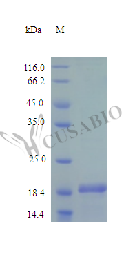 Recombinant Human Desert hedgehog protein(DHH),partial (Active) (CSB-AP000411HU)