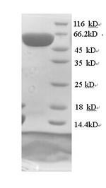 (Tris-Glycine gel) Discontinuous SDS-PAGE (reduced) with 5% enrichment gel and 15% separation gel.