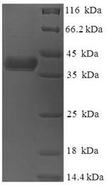 (Tris-Glycine gel) Discontinuous SDS-PAGE (reduced) with 5% enrichment gel and 15% separation gel.