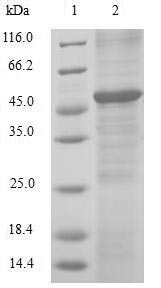 (Tris-Glycine gel) Discontinuous SDS-PAGE (reduced) with 5% enrichment gel and 15% separation gel.