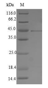 (Tris-Glycine gel) Discontinuous SDS-PAGE (reduced) with 5% enrichment gel and 15% separation gel.