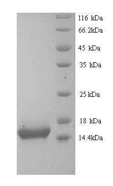 (Tris-Glycine gel) Discontinuous SDS-PAGE (reduced) with 5% enrichment gel and 15% separation gel.