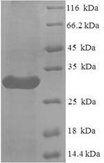 (Tris-Glycine gel) Discontinuous SDS-PAGE (reduced) with 5% enrichment gel and 15% separation gel.