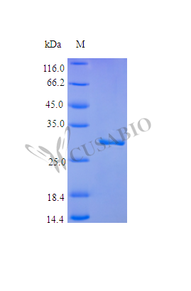 Plasminogen protein (PLG) (Active) Tag-Free (E. coli-derived, recombinant human)