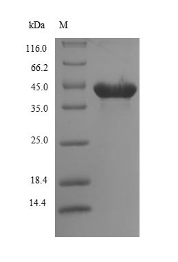 (Tris-Glycine gel) Discontinuous SDS-PAGE (reduced) with 5% enrichment gel and 15% separation gel.