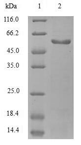(Tris-Glycine gel) Discontinuous SDS-PAGE (reduced) with 5% enrichment gel and 15% separation gel.