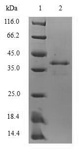 (Tris-Glycine gel) Discontinuous SDS-PAGE (reduced) with 5% enrichment gel and 15% separation gel.