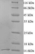 (Tris-Glycine gel) Discontinuous SDS-PAGE (reduced) with 5% enrichment gel and 15% separation gel.