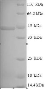 (Tris-Glycine gel) Discontinuous SDS-PAGE (reduced) with 5% enrichment gel and 15% separation gel.
