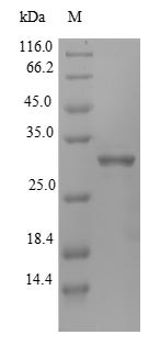 (Tris-Glycine gel) Discontinuous SDS-PAGE (reduced) with 5% enrichment gel and 15% separation gel.