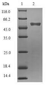 (Tris-Glycine gel) Discontinuous SDS-PAGE (reduced) with 5% enrichment gel and 15% separation gel.
