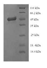 (Tris-Glycine gel) Discontinuous SDS-PAGE (reduced) with 5% enrichment gel and 15% separation gel.