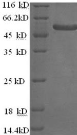 (Tris-Glycine gel) Discontinuous SDS-PAGE (reduced) with 5% enrichment gel and 15% separation gel.