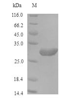 (Tris-Glycine gel) Discontinuous SDS-PAGE (reduced) with 5% enrichment gel and 15% separation gel.