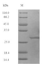 (Tris-Glycine gel) Discontinuous SDS-PAGE (reduced) with 5% enrichment gel and 15% separation gel.