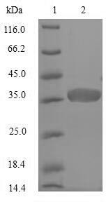 (Tris-Glycine gel) Discontinuous SDS-PAGE (reduced) with 5% enrichment gel and 15% separation gel.