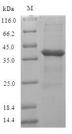 (Tris-Glycine gel) Discontinuous SDS-PAGE (reduced) with 5% enrichment gel and 15% separation gel.
